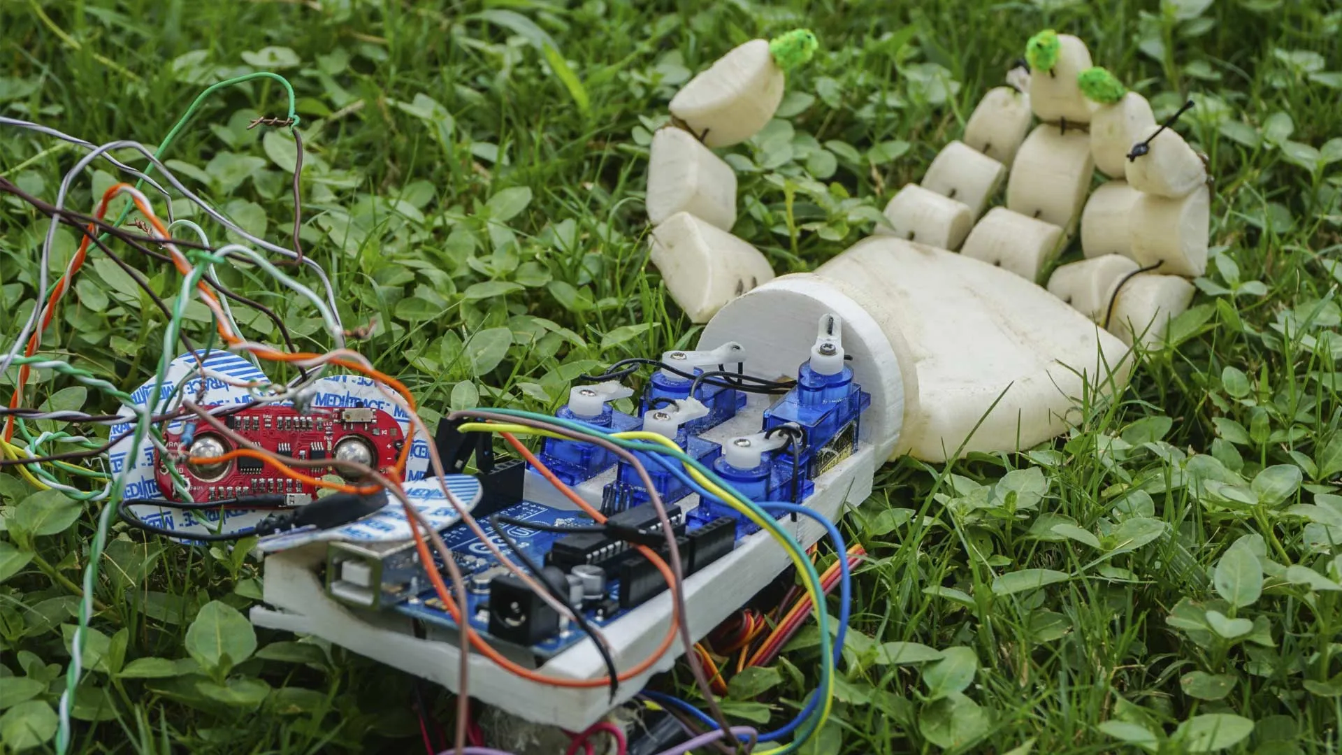 Crea empresa de prótesis para personas con discapacidad