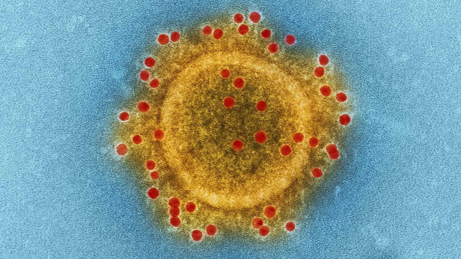 Coronavirus investigado por científicos del Tec de Monterrey