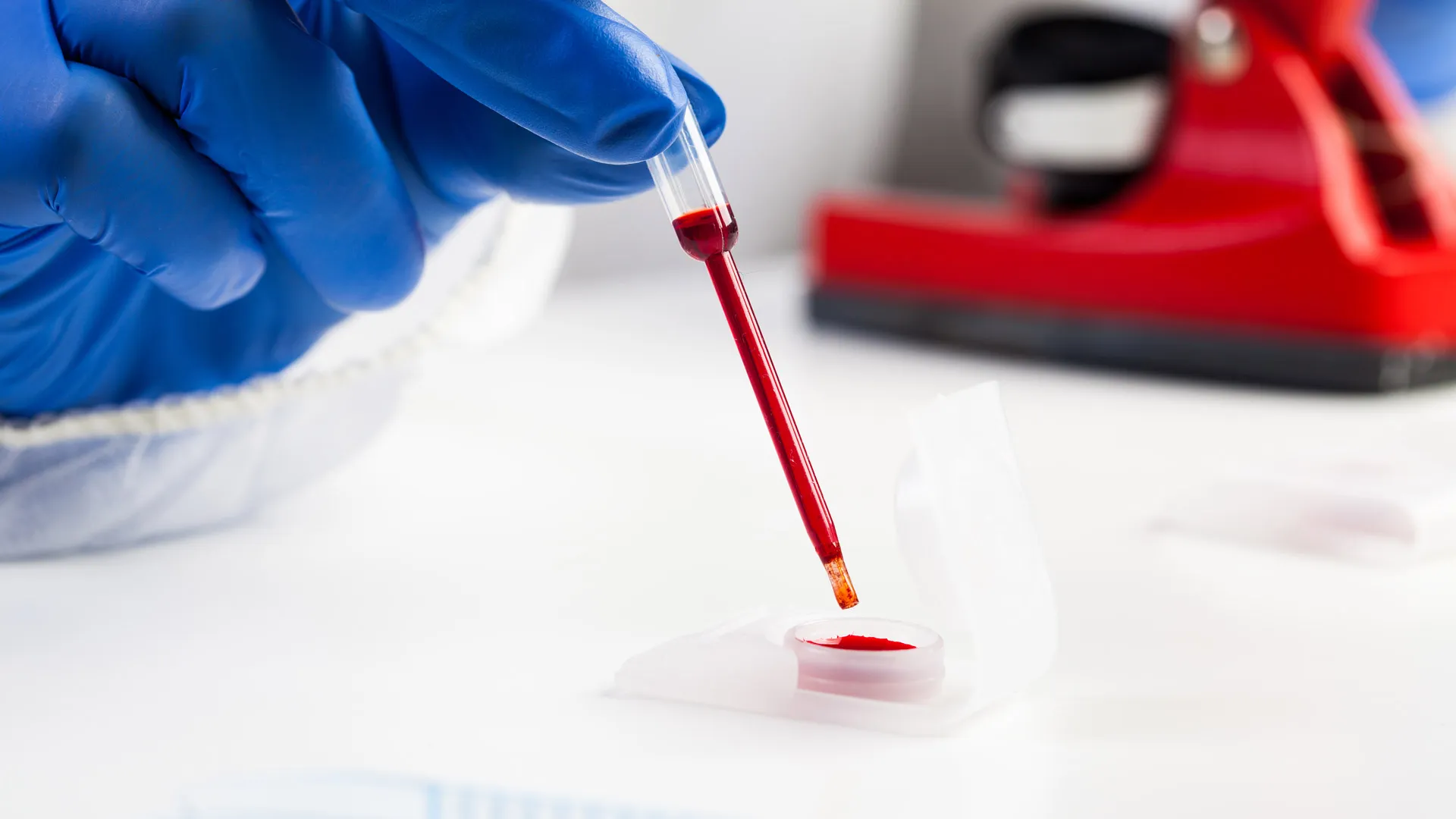 This is how plasma treatment works for patients with COVID-19