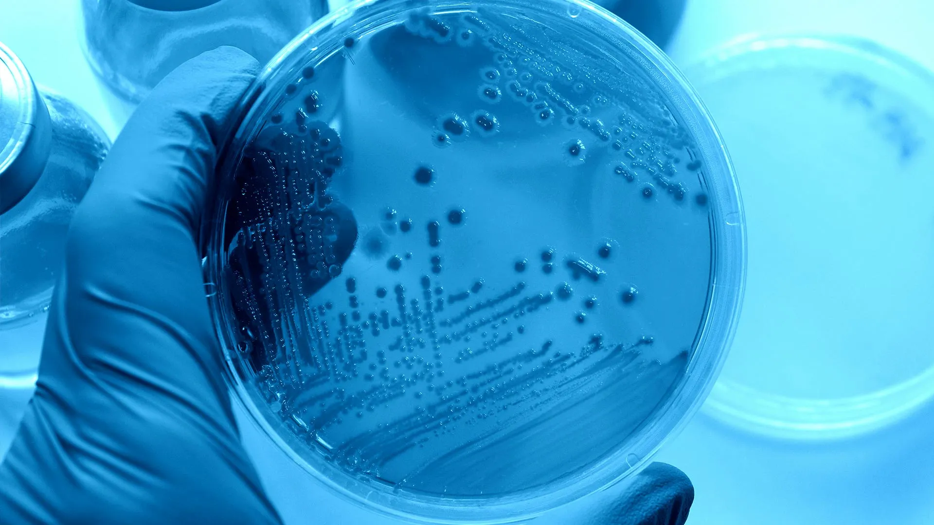 Alumno del Tec crea sanitizador para combatir virus y bacterias 