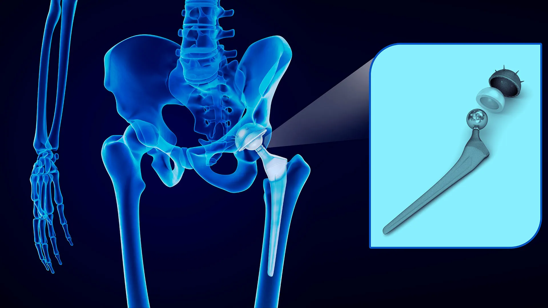 Crea sistema con realidad aumentada en cirugía de pelvis