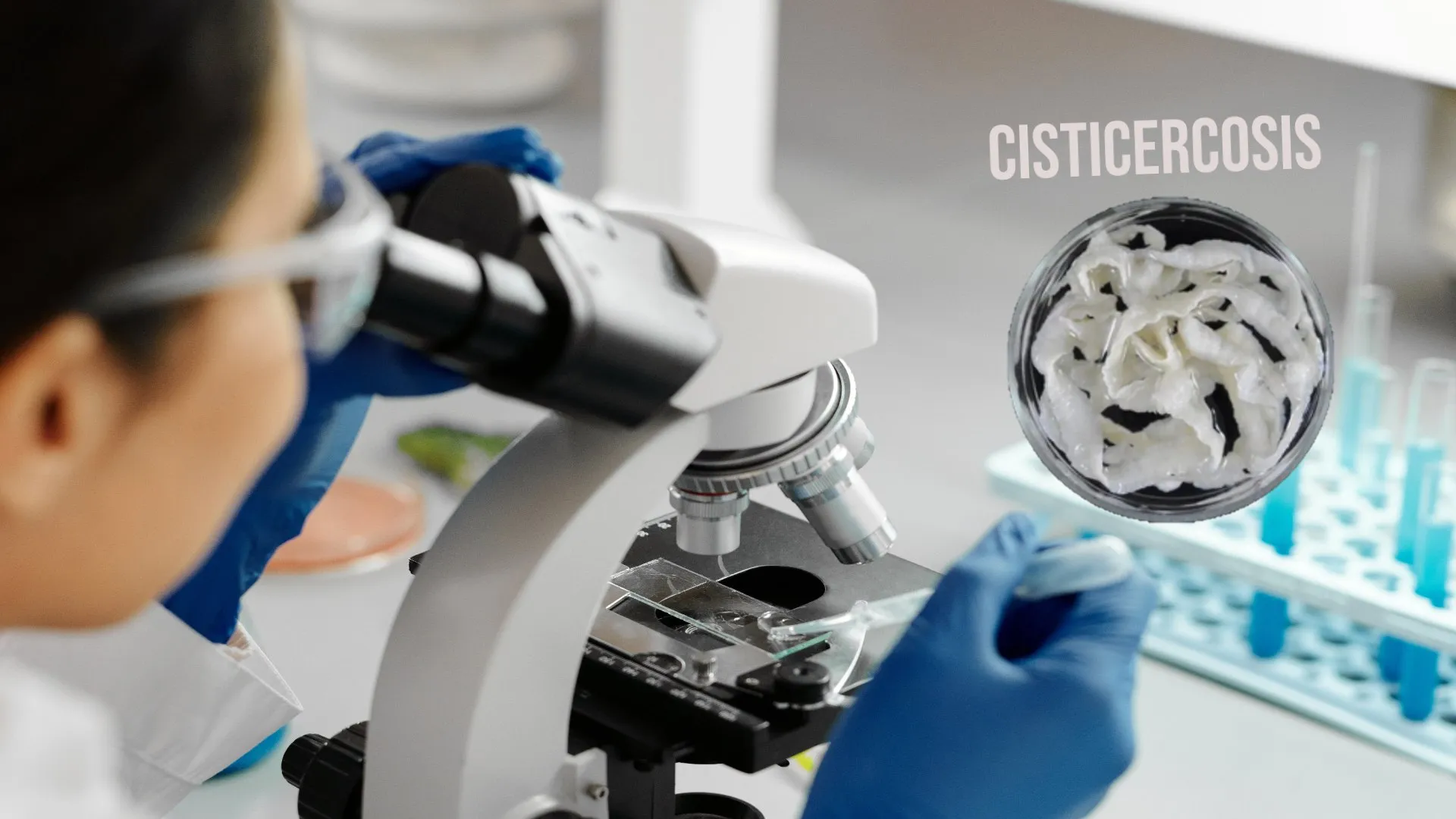 LEKA, una prueba para detectar la cisticercosis