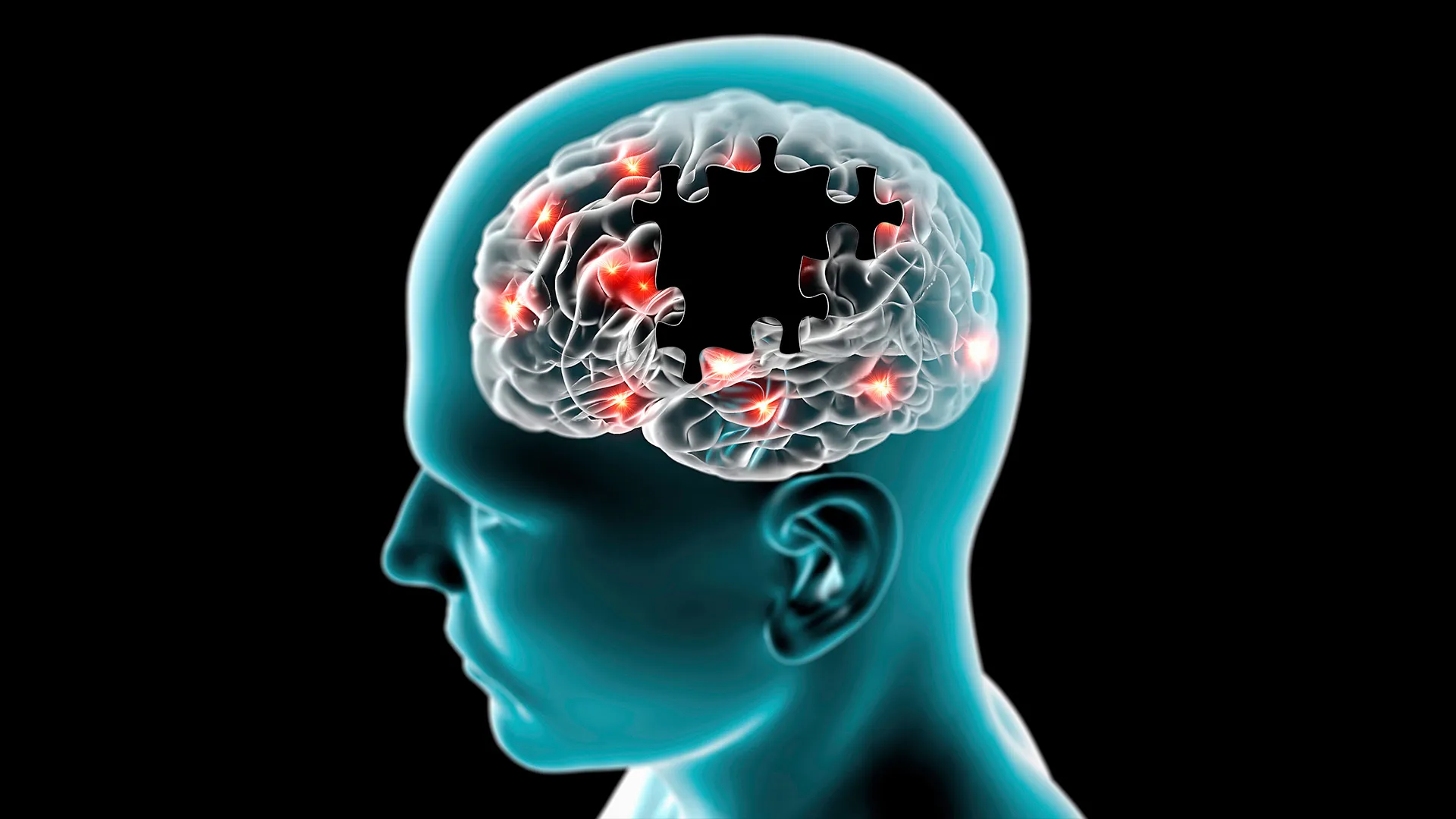 Estudiantes Tec desarrollan tratamiento para el Parkinson