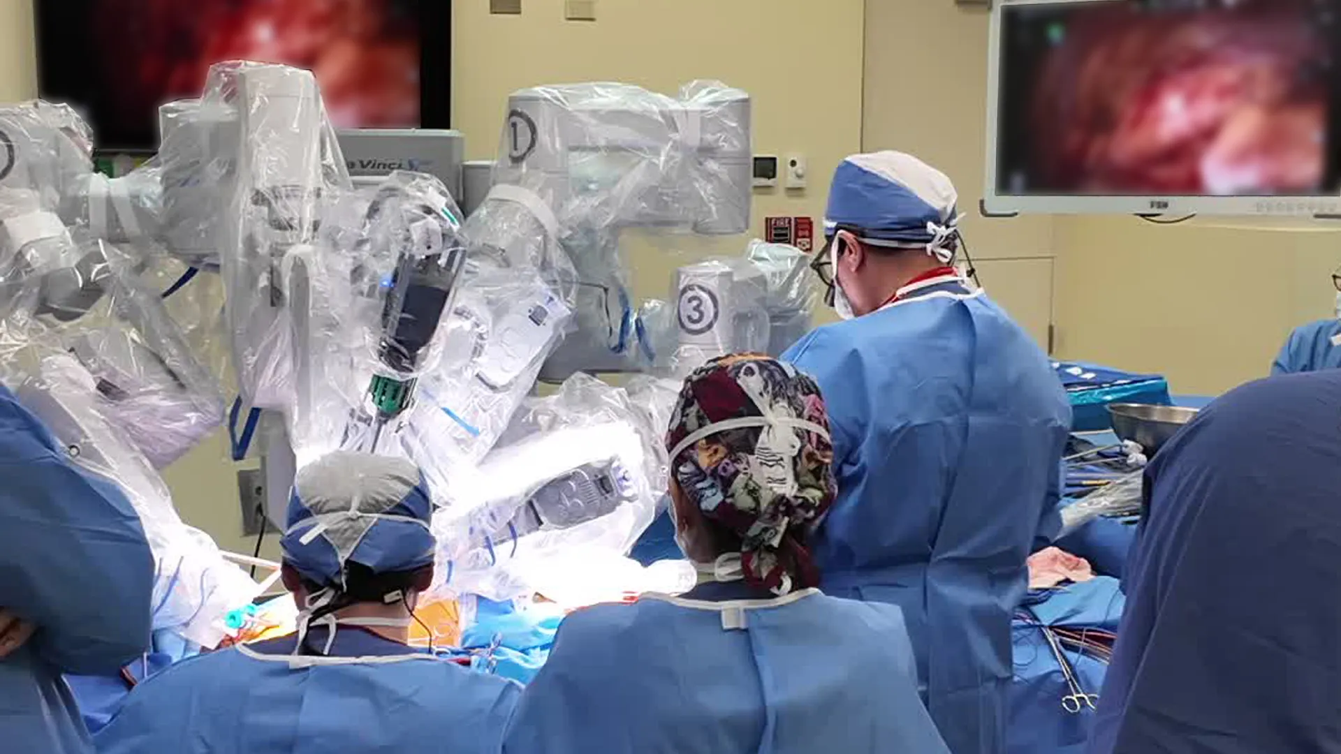 TecSalud realiza la primera valvuloplastia mitral por cirugía robótica en México..