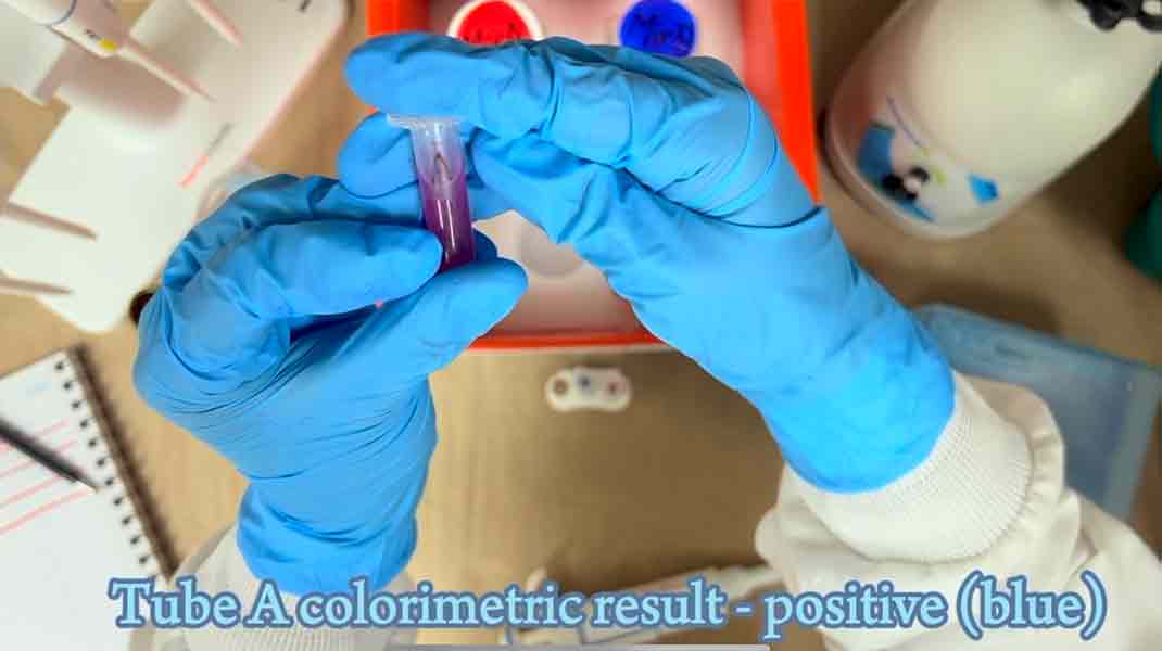 Detectar cáncer de mama con dispositivo de bajo costo, proyecto Mi-Biomark.