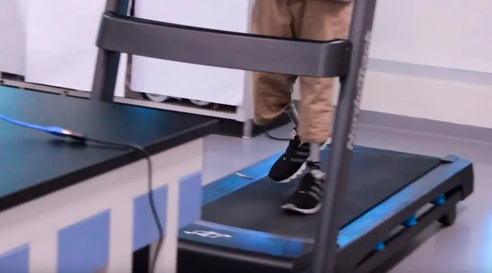 Proactible ayuda a personas que necesitan pr&oacute;tesis de pierna