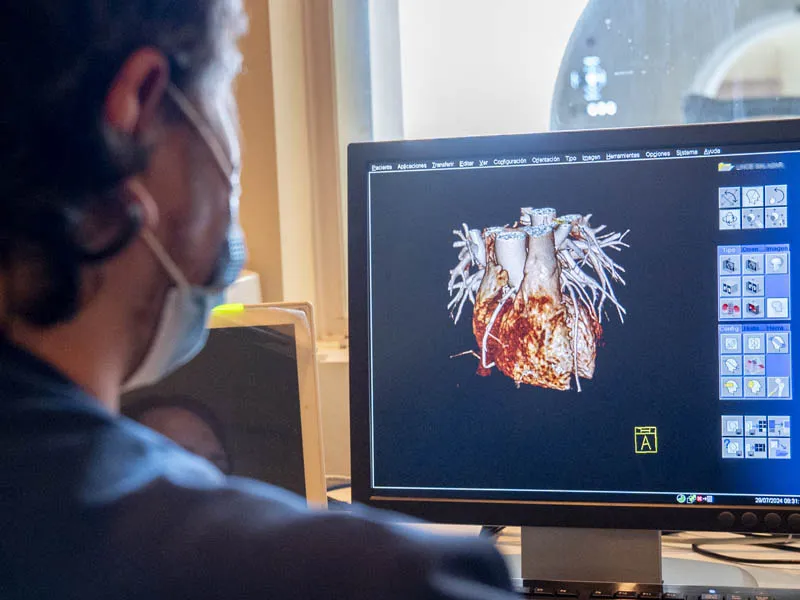 TecSalud desarrolló la Clínica de Insuficiencia Cardiaca como resultado de los esfuerzos de su participación en el programa de la AHA.