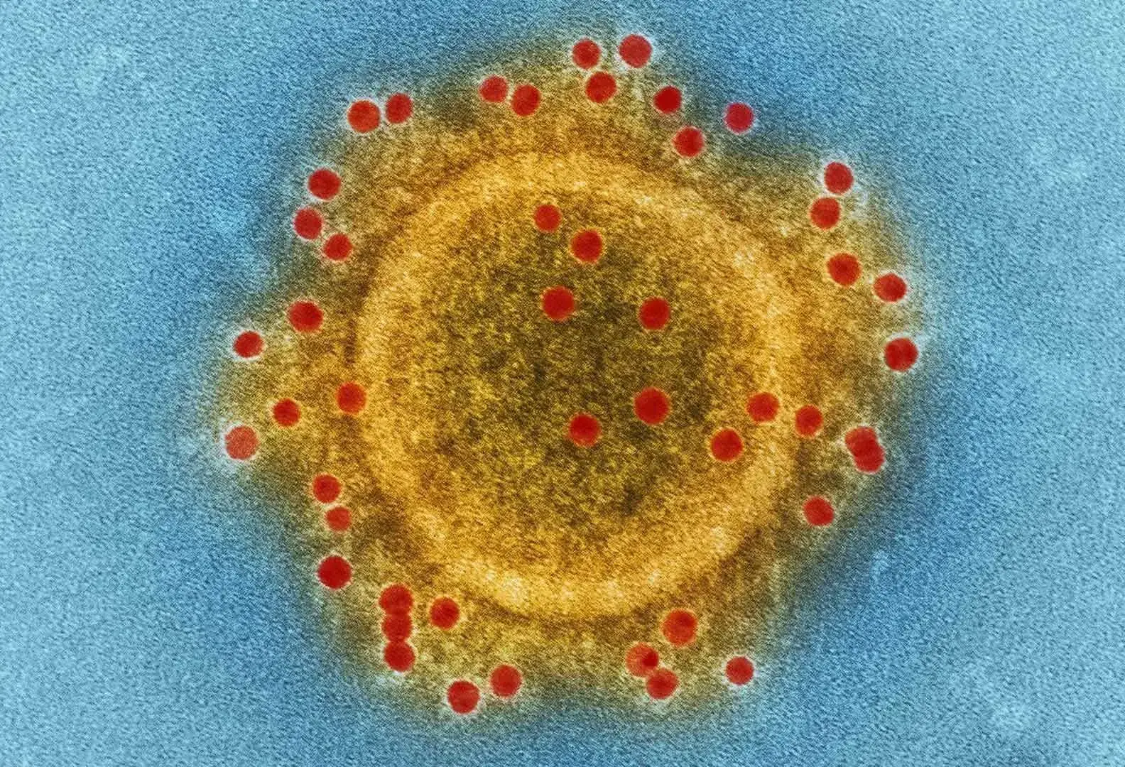 Coronavirus investigado por científicos del Tec de Monterrey